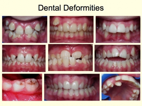 Why Straight Teeth Matter: Sokoly Dental: General and Cosmetic Dentistry